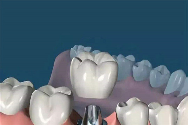 新源好的牙齒矯正類型醫院